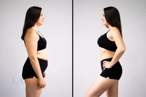link between body image and mental health Isle of Isla