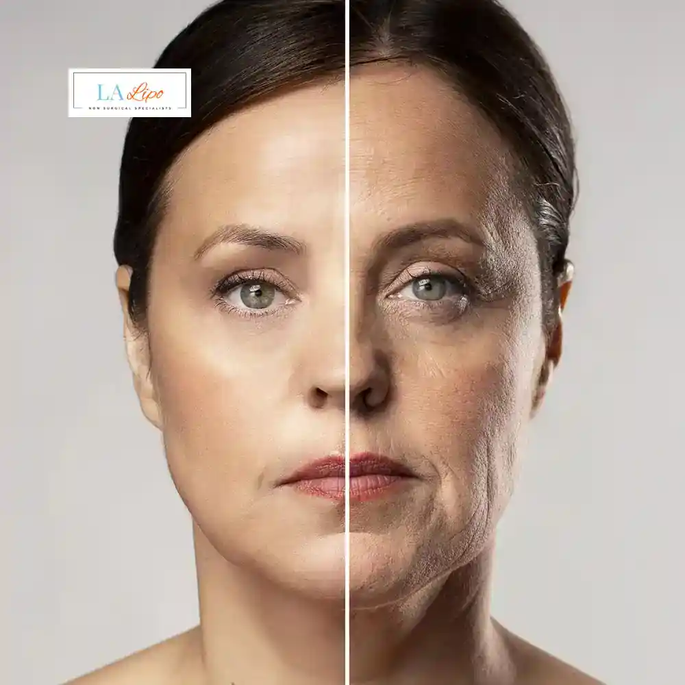 How Can You Tell If Non-Surgical Skin Tightening Is Right for You Isle of Isla?
